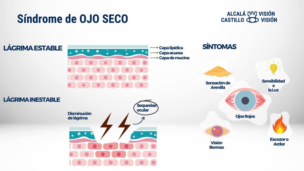 Todo sobre el ojo seco